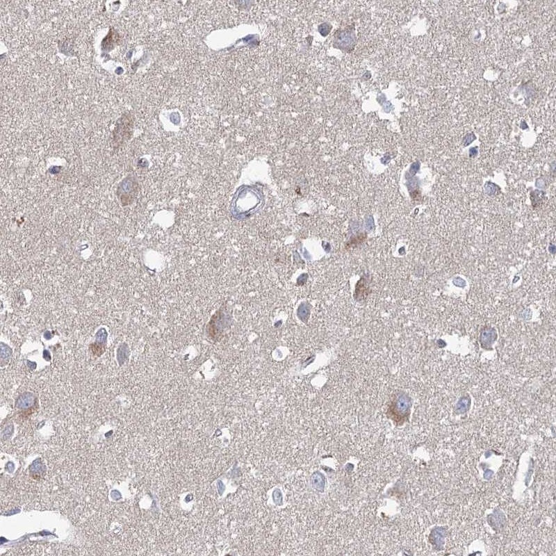 ARHGAP44 Antibody - BSA Free Immunohistochemistry-Paraffin: ARHGAP44 Antibody [NBP1-93624]