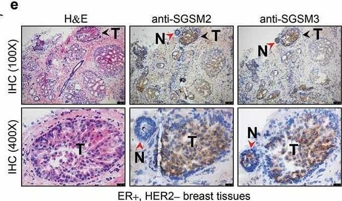 SGSM2 Antibody - BSA Free