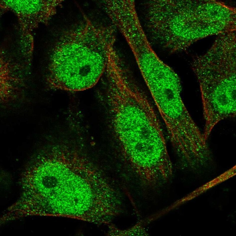 TTC37 Antibody - BSA Free Immunocytochemistry/ Immunofluorescence: TTC37 Antibody [NBP1-93640]