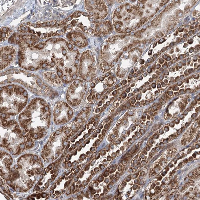 TTC37 Antibody - BSA Free Immunohistochemistry: TTC37 Antibody - BSA Free [NBP1-93640]
