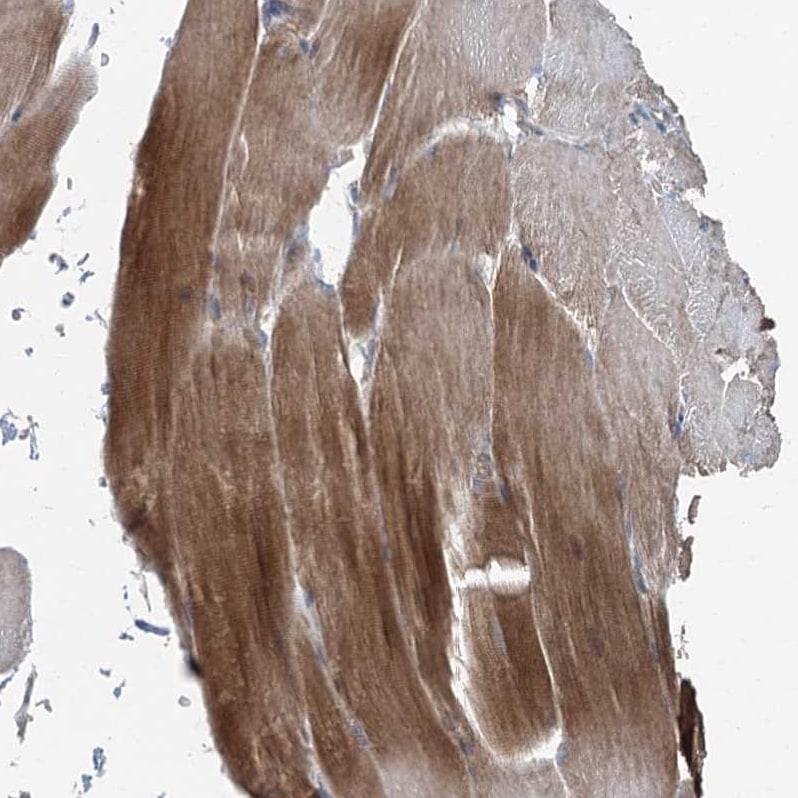 TTC37 Antibody - BSA Free Immunohistochemistry: TTC37 Antibody - BSA Free [NBP1-93640]