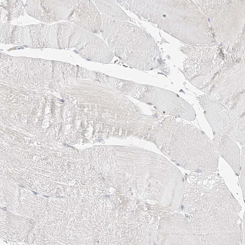 TRANK1 Antibody - BSA Free Immunohistochemistry-Paraffin: TRANK1 Antibody [NBP1-93641]