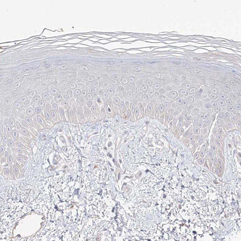 TRANK1 Antibody - BSA Free Immunohistochemistry-Paraffin: TRANK1 Antibody [NBP1-93641]