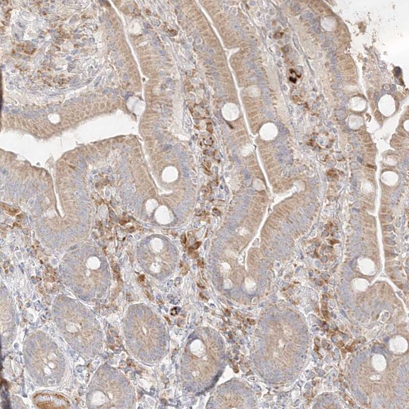 TRANK1 Antibody - BSA Free Immunohistochemistry-Paraffin: TRANK1 Antibody [NBP1-93641]