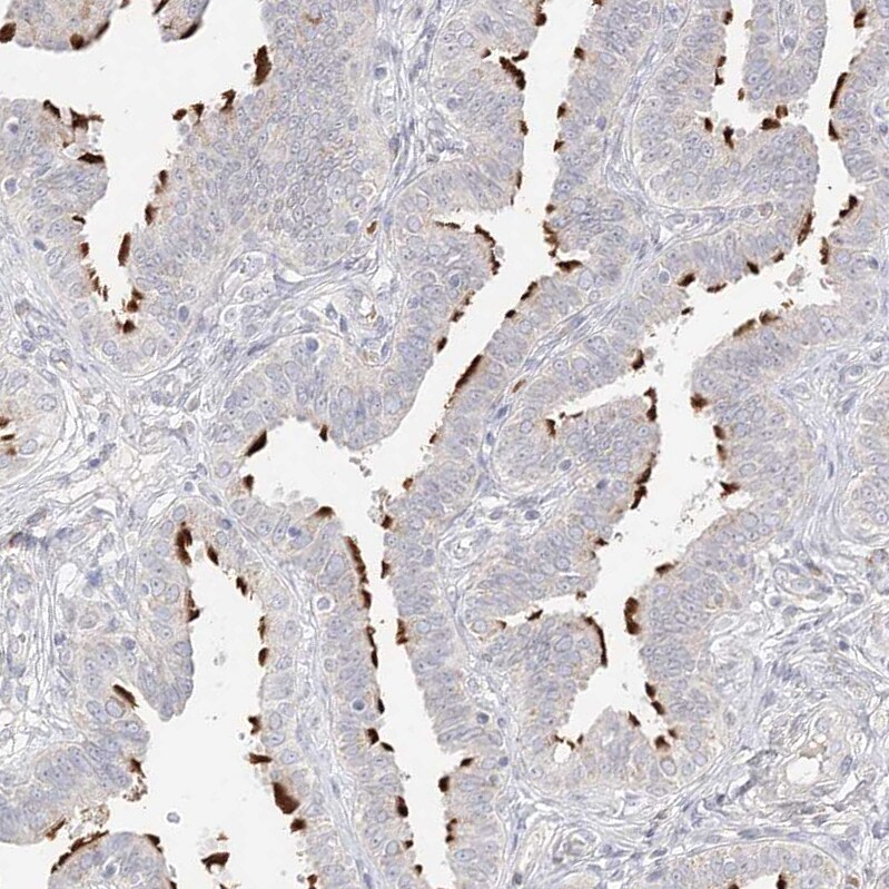TRANK1 Antibody - BSA Free Immunohistochemistry-Paraffin: TRANK1 Antibody [NBP1-93641]