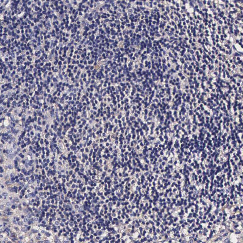 TECPR2 Antibody - BSA Free Immunohistochemistry: TECPR2 Antibody - BSA Free [NBP1-93642]