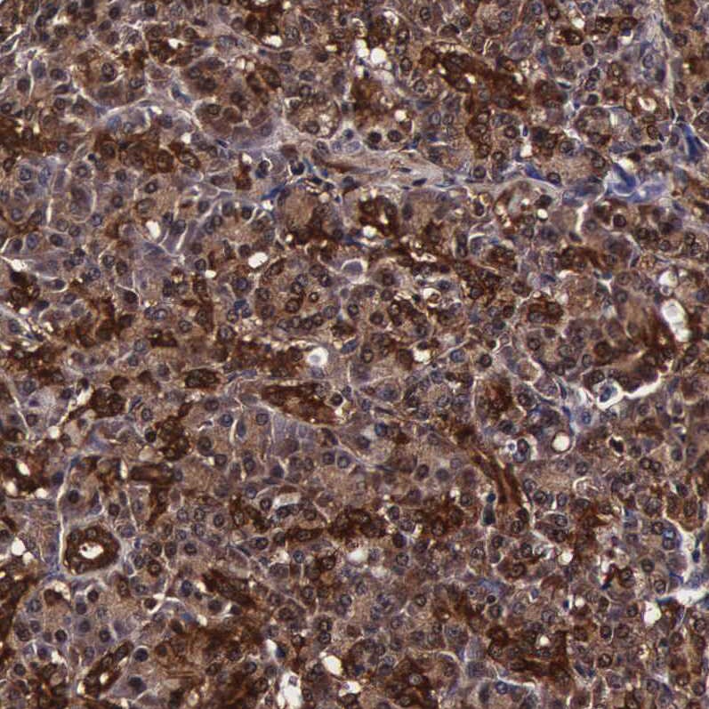 TECPR2 Antibody - BSA Free Immunohistochemistry: TECPR2 Antibody - BSA Free [NBP1-93642]