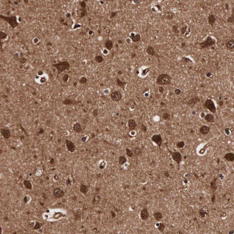 TECPR2 Antibody - BSA Free Immunohistochemistry: TECPR2 Antibody - BSA Free [NBP1-93642]