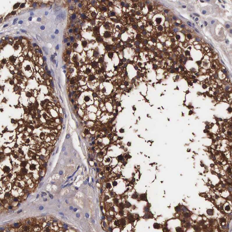 TECPR2 Antibody - BSA Free Immunohistochemistry: TECPR2 Antibody - BSA Free [NBP1-93642]