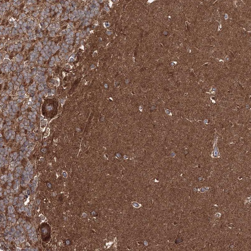 DOCK3 Antibody - BSA Free Immunohistochemistry-Paraffin: DOCK3 Antibody [NBP1-93647]