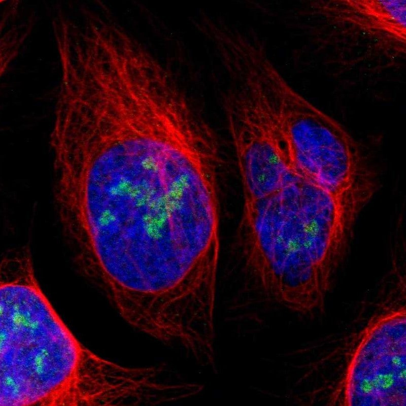 URB2 Antibody - BSA Free Immunocytochemistry/ Immunofluorescence: URB2 Antibody [NBP1-93655]