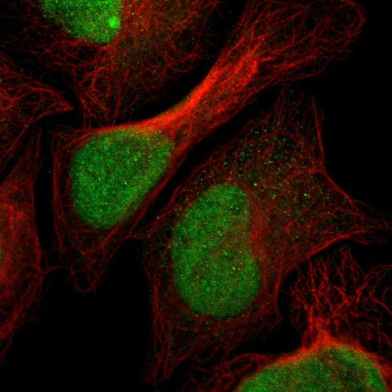 SPCS2 Antibody - BSA Free Immunocytochemistry/ Immunofluorescence: SPCS2 Antibody - BSA Free [NBP1-93656]