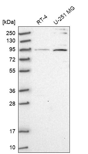 ARHGAP11A Antibody - BSA Free Western Blot: ARHGAP11A Antibody - BSA Free [NBP1-93657]