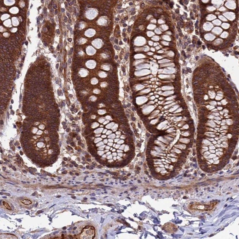 CCDC125 Antibody - BSA Free Immunohistochemistry: CCDC125 Antibody - BSA Free [NBP1-93660]