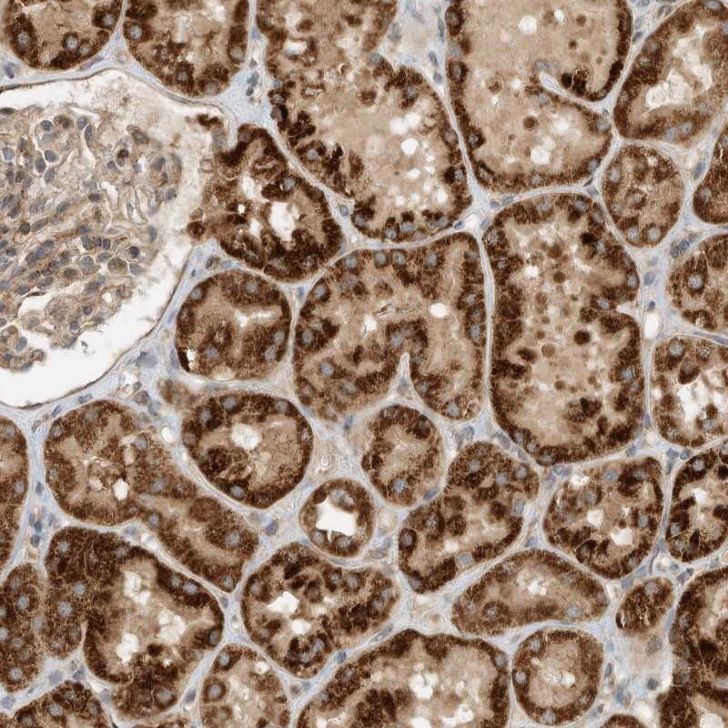 CPAMD8 Antibody - BSA Free Immunohistochemistry: CPAMD8 Antibody - BSA Free [NBP1-93661]