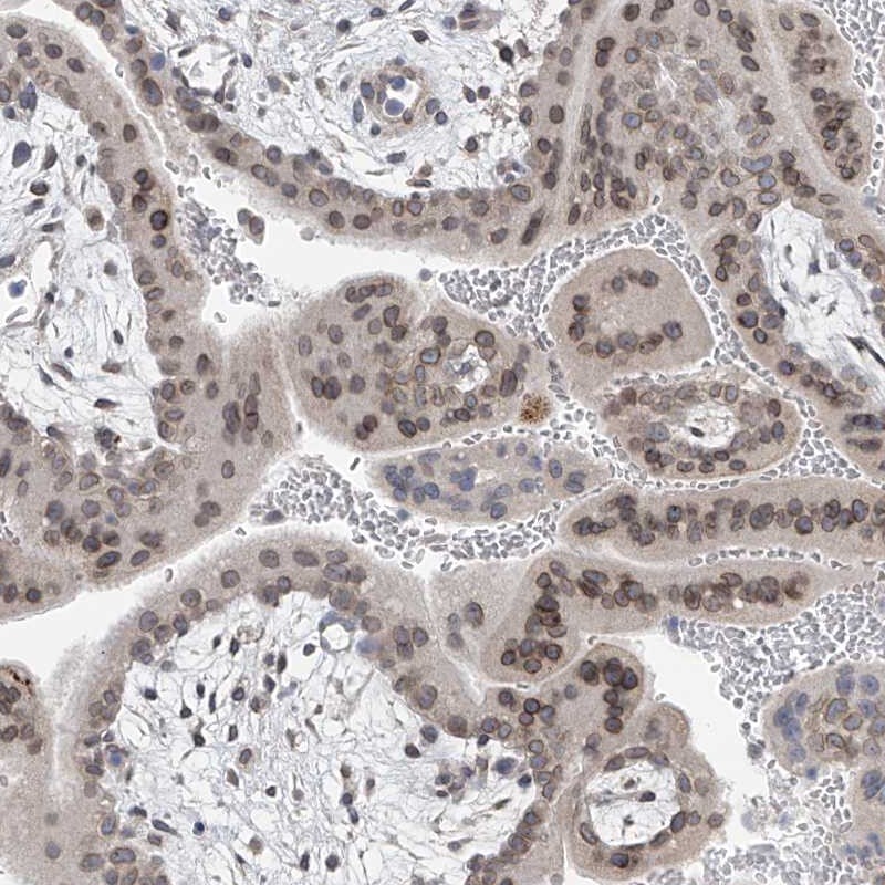 KRTAP25-1 Antibody - BSA Free Immunohistochemistry-Paraffin: KRTAP25-1 Antibody [NBP1-93664]