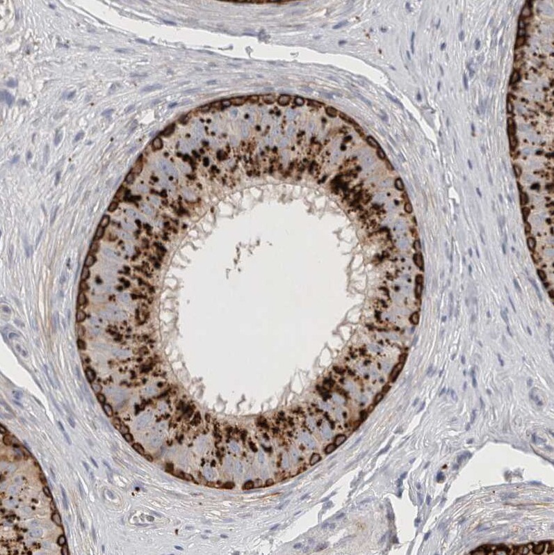 LYAG/GAA Antibody - BSA Free Immunohistochemistry-Paraffin: GREB1 Antibody [NBP2-48576]