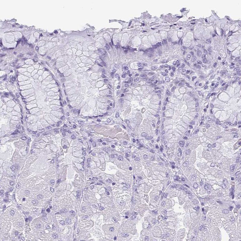KRT78 Antibody - BSA Free Immunohistochemistry-Paraffin: KRT78 Antibody [NBP1-93671]