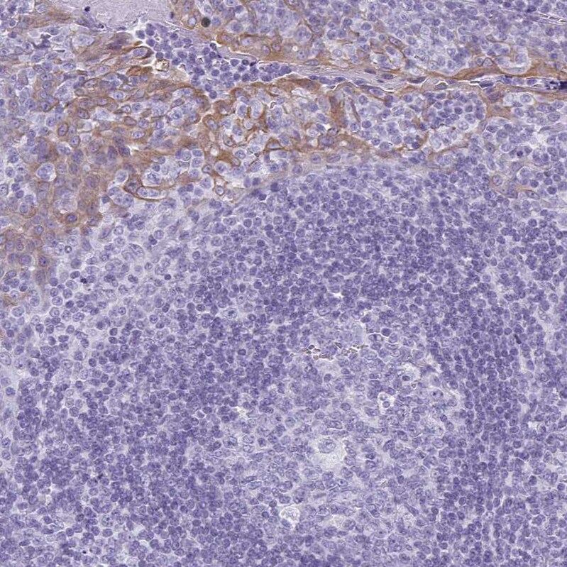 KRT78 Antibody - BSA Free Immunohistochemistry-Paraffin: KRT78 Antibody [NBP1-93671]