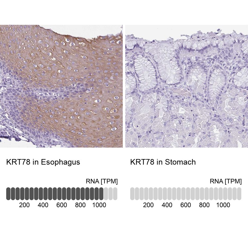 KRT78 Antibody - BSA Free Immunohistochemistry-Paraffin: KRT78 Antibody [NBP1-93671]