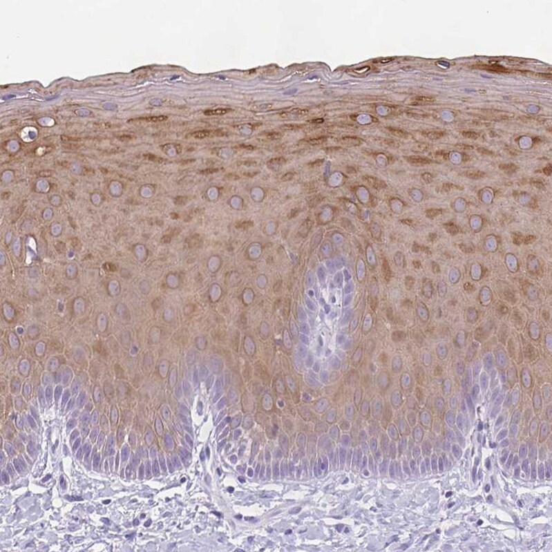 KRT78 Antibody - BSA Free Immunohistochemistry-Paraffin: KRT78 Antibody [NBP1-93671]