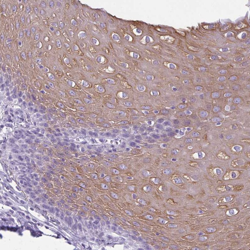 KRT78 Antibody - BSA Free Immunohistochemistry-Paraffin: KRT78 Antibody [NBP1-93671]