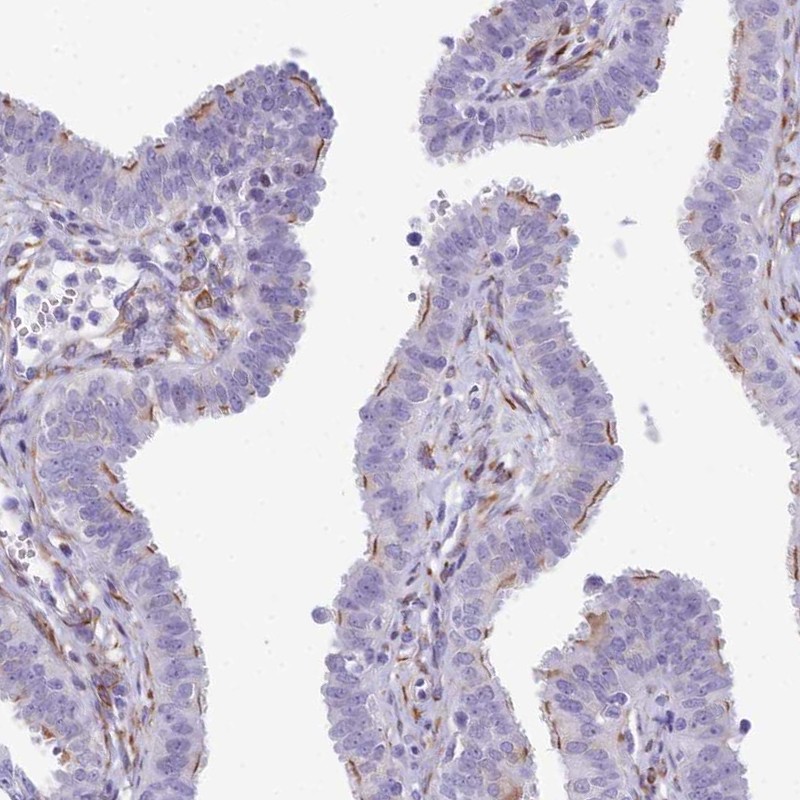 CC2D2A Antibody - BSA Free Immunohistochemistry: CC2D2A Antibody - BSA Free [NBP1-93673]