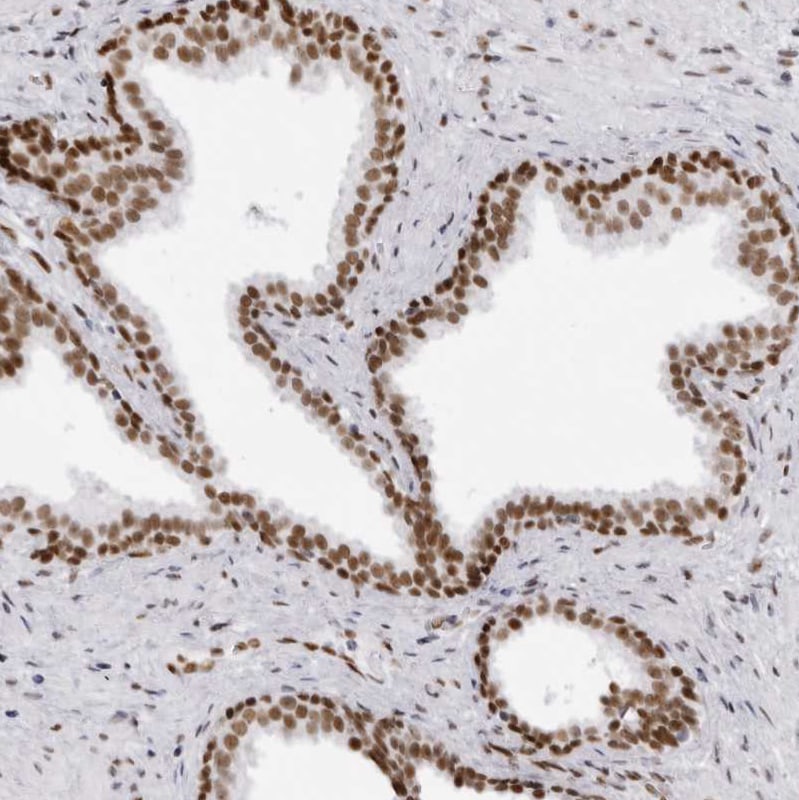 IRF2BP2 Antibody - BSA Free Immunohistochemistry: IRF2BP2 Antibody - BSA Free [NBP1-93674]