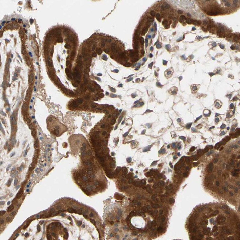 Testis Development Related Protein Antibody - BSA Free Immunohistochemistry: Testis Development Related Protein Antibody - BSA Free [NBP1-93675]
