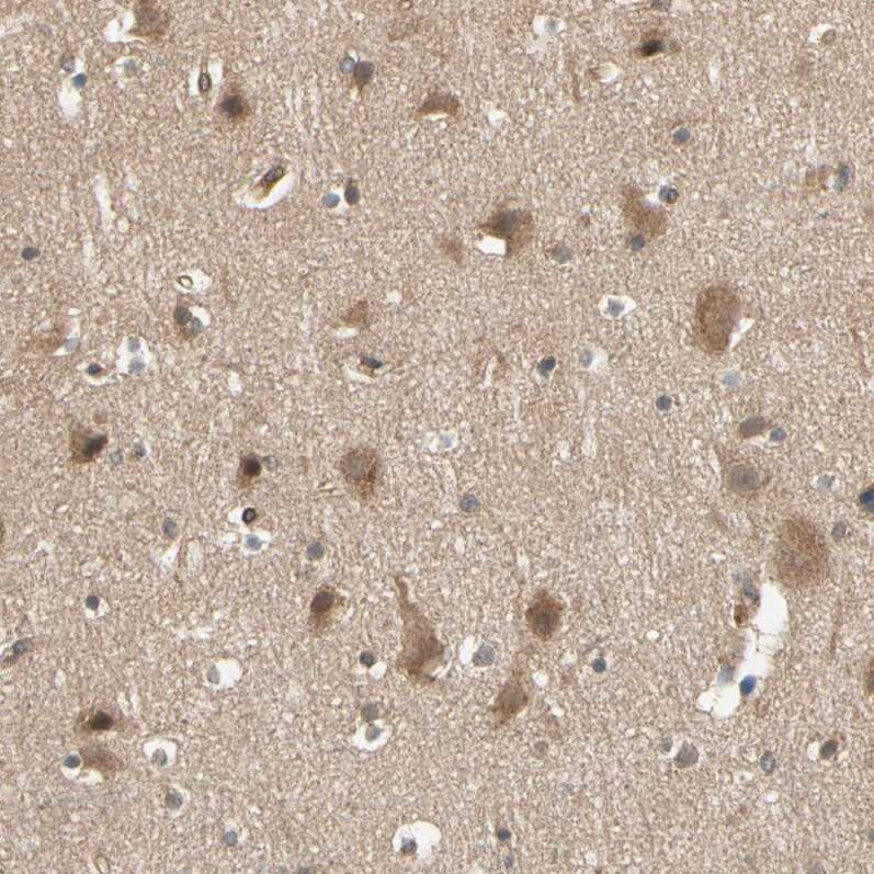 Testis Development Related Protein Antibody - BSA Free Immunohistochemistry: Testis Development Related Protein Antibody - BSA Free [NBP1-93675]