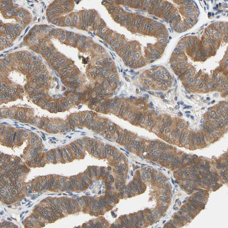 Testis Development Related Protein Antibody - BSA Free Immunohistochemistry: Testis Development Related Protein Antibody - BSA Free [NBP1-93675]