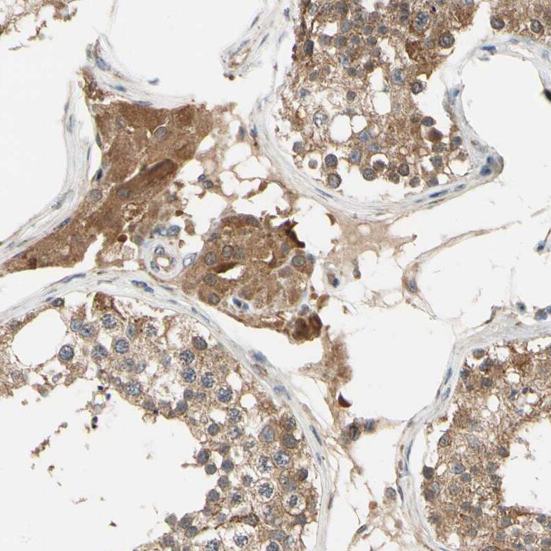 Testis Development Related Protein Antibody - BSA Free Immunohistochemistry: Testis Development Related Protein Antibody - BSA Free [NBP1-93675]