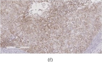 IGSF9 Antibody