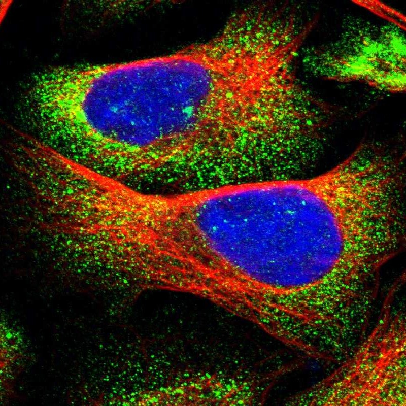 CDR2L Antibody - BSA Free Immunocytochemistry/ Immunofluorescence: CDR2L Antibody [NBP1-93681]