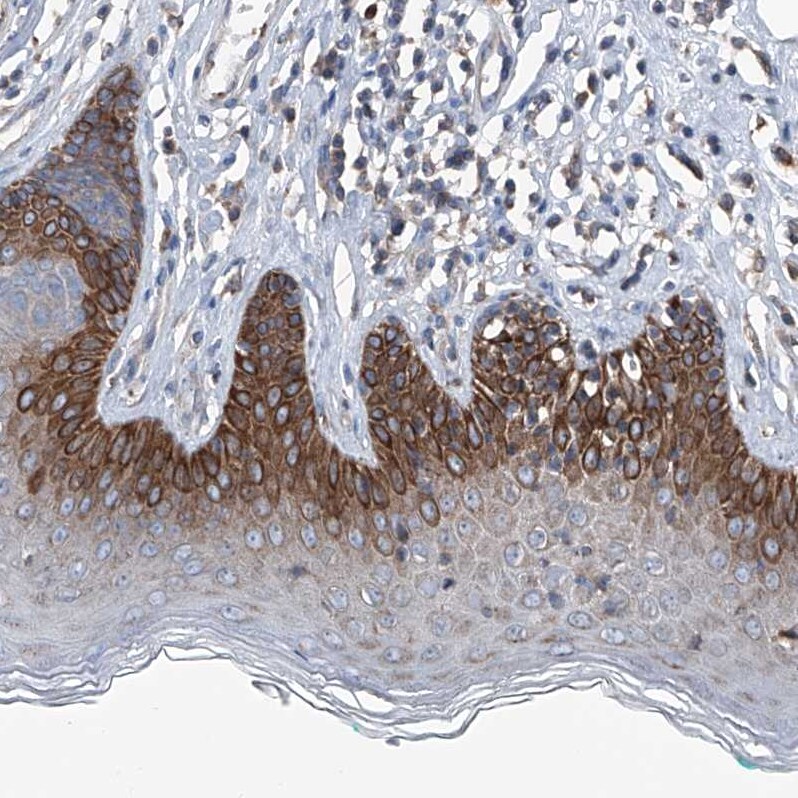 AGPAT9 Antibody - BSA Free Immunohistochemistry: AGPAT9 Antibody - BSA Free [NBP1-93692]