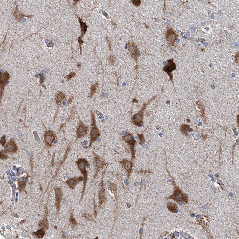AGPAT9 Antibody - BSA Free Immunohistochemistry: AGPAT9 Antibody - BSA Free [NBP1-93692]