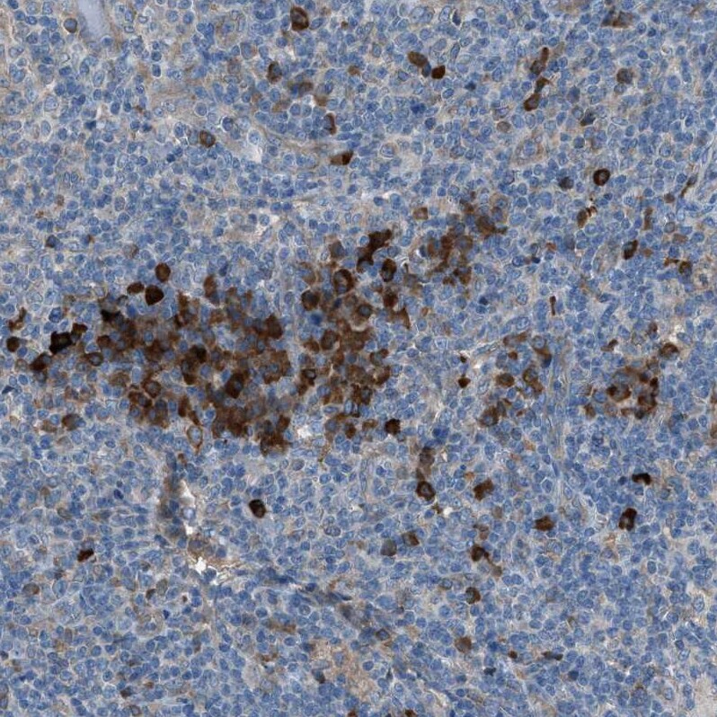 HEG1 Antibody - BSA Free Immunohistochemistry: HEG1 Antibody - BSA Free [NBP1-93700]
