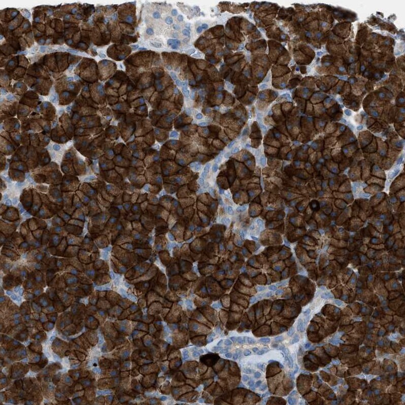 HEG1 Antibody - BSA Free Immunohistochemistry: HEG1 Antibody - BSA Free [NBP1-93700]
