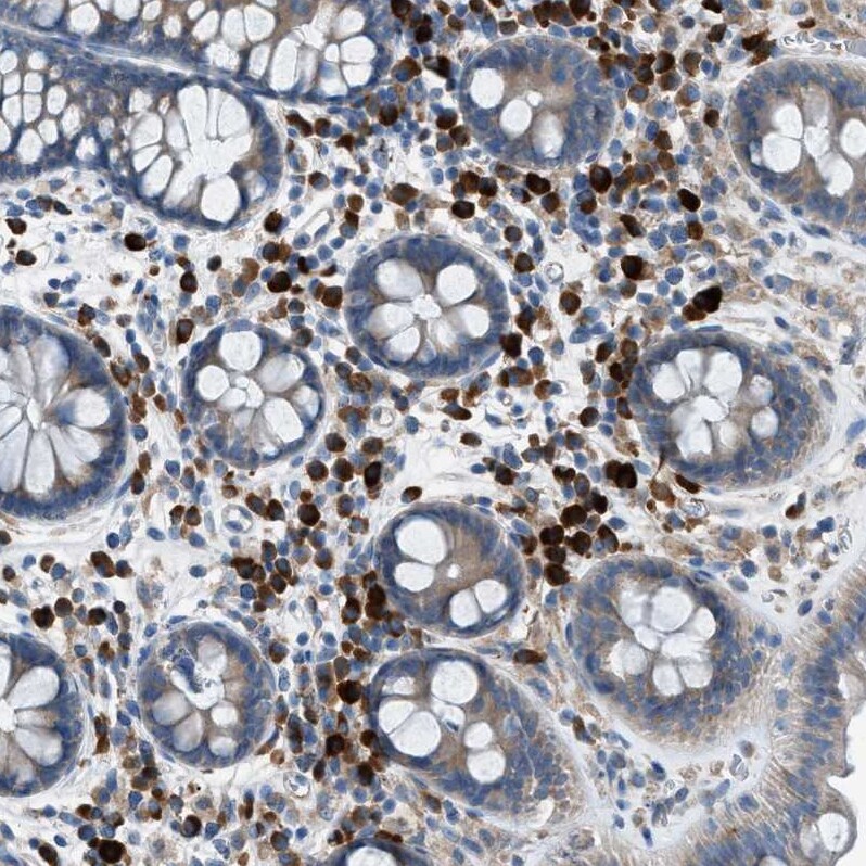 HEG1 Antibody - BSA Free Immunohistochemistry: HEG1 Antibody - BSA Free [NBP1-93700]