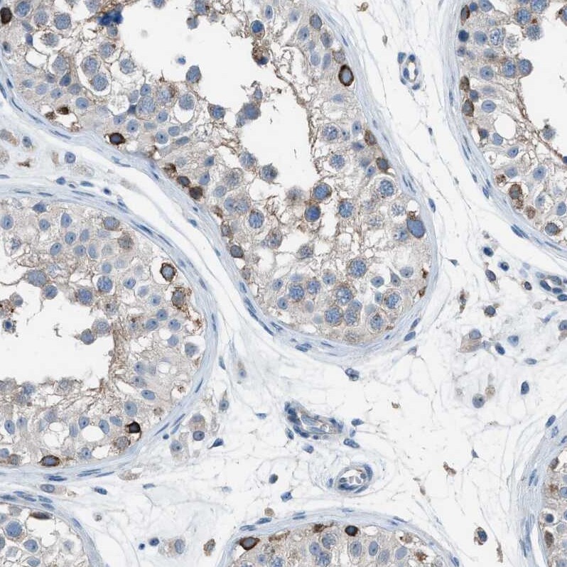 HEG1 Antibody - BSA Free Immunohistochemistry: HEG1 Antibody - BSA Free [NBP1-93700]