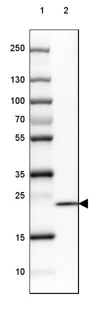 SPINK13 Antibody - BSA Free Western Blot: SPINK13 Antibody - BSA Free [NBP1-93701]