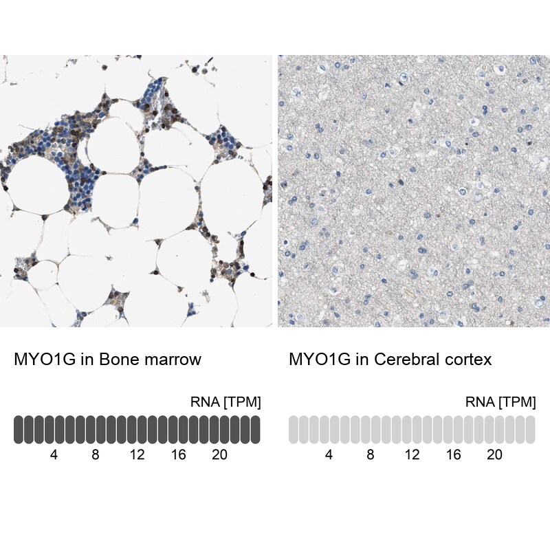 MYO1G Antibody - BSA Free Immunohistochemistry: MYO1G Antibody - BSA Free [NBP1-93704]