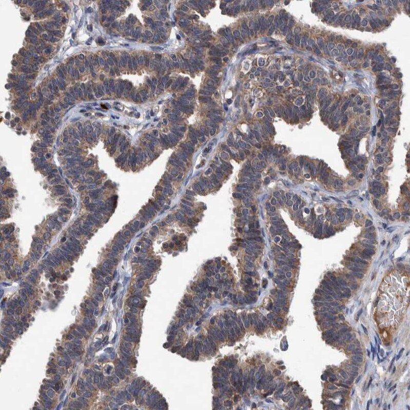 ITIH3 Antibody - BSA Free Immunohistochemistry: ITIH3 Antibody - BSA Free [NBP1-93705]
