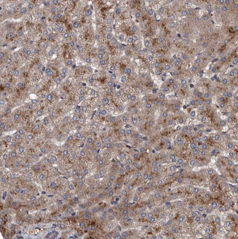 ITIH3 Antibody - BSA Free Immunohistochemistry: ITIH3 Antibody - BSA Free [NBP1-93705]