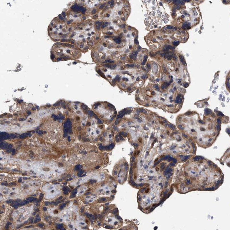 ITIH3 Antibody - BSA Free Immunohistochemistry: ITIH3 Antibody - BSA Free [NBP1-93705]