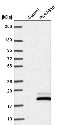 PLA2G10 Antibody - BSA Free Western Blot: PLA2G10 Antibody - BSA Free [NBP1-93706]
