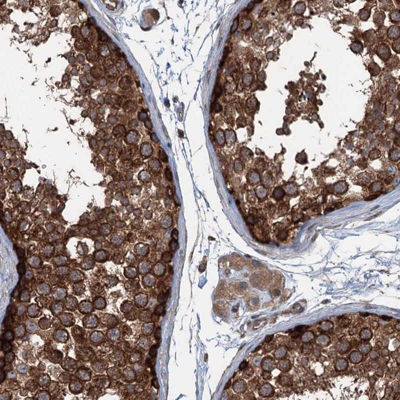 TRAPPC8 Antibody - BSA Free Immunohistochemistry-Paraffin: TRAPPC8 Antibody [NBP1-93708]