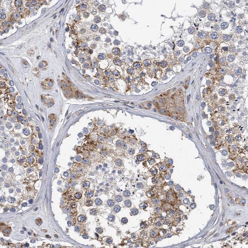 CCDC47 Antibody - BSA Free Immunohistochemistry-Paraffin: CCDC47 Antibody [NBP1-93717]