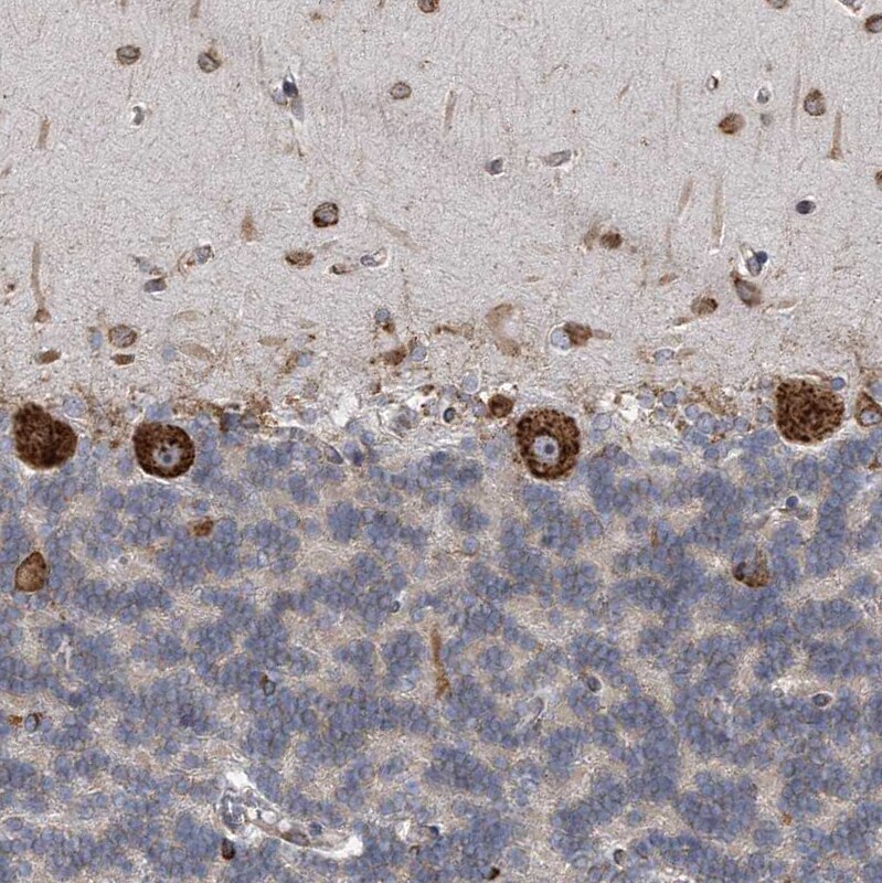 CCDC47 Antibody - BSA Free Immunohistochemistry-Paraffin: CCDC47 Antibody [NBP1-93717]