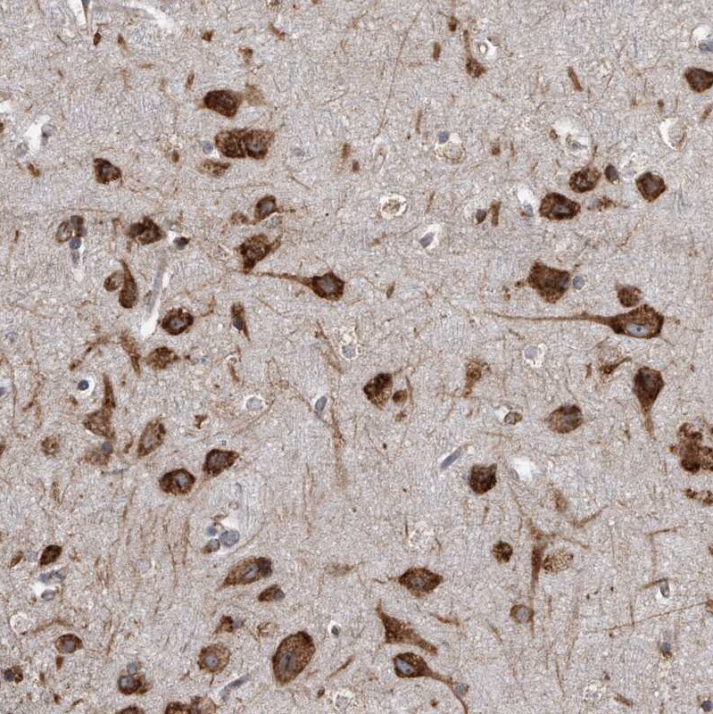 CCDC47 Antibody - BSA Free Immunohistochemistry-Paraffin: CCDC47 Antibody [NBP1-93717]